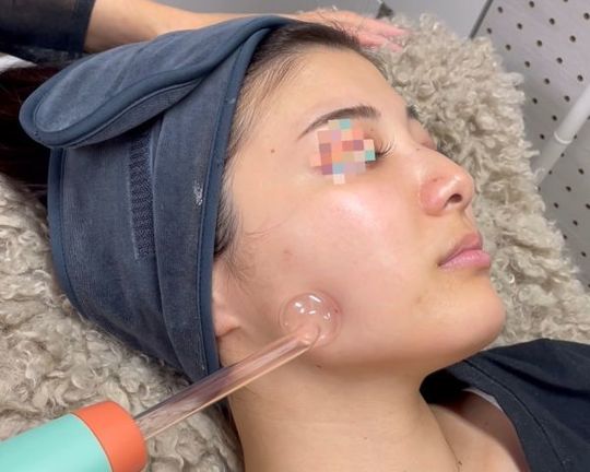 ハンドケア写真